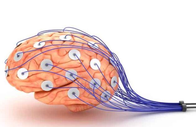 EEG
